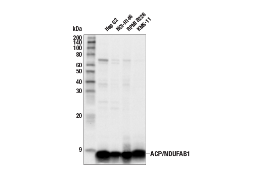 undefined Image 24: Electron Transport Chain (Complex I, III, IV) Antibody Sampler Kit