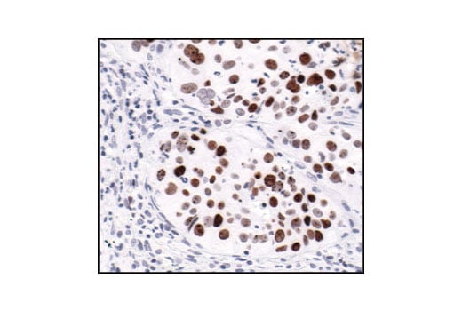 Immunohistochemistry Image 3: Phospho-Histone H2A.X (Ser139) (20E3) Rabbit Monoclonal Antibody (BSA and Azide Free)