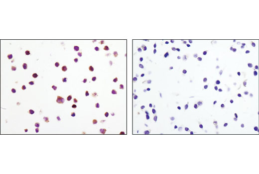 Immunohistochemistry Image 4: Phospho-MEK1/2 (Ser221) (166F8) Rabbit Monoclonal Antibody (BSA and Azide Free)