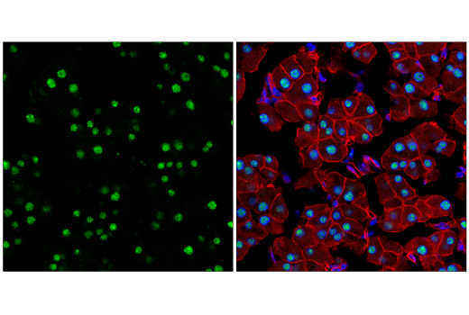 Immunofluorescence Image 4: NSUN2 (E9Y5E) Rabbit Monoclonal Antibody