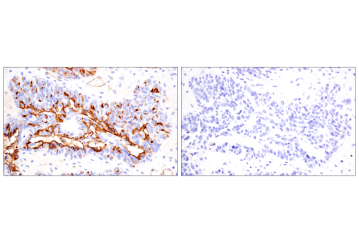 Immunohistochemistry Image 13: PODXL (E8O1S) Rabbit Monoclonal Antibody (BSA and Azide Free)