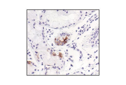 Immunohistochemistry Image 4: Phospho-IKK alpha/beta (Ser176/180) (16A6) Rabbit Monoclonal Antibody