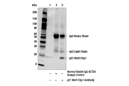 Immunoprecipitation Image 1: p21 Waf1/Cip1 Antibody