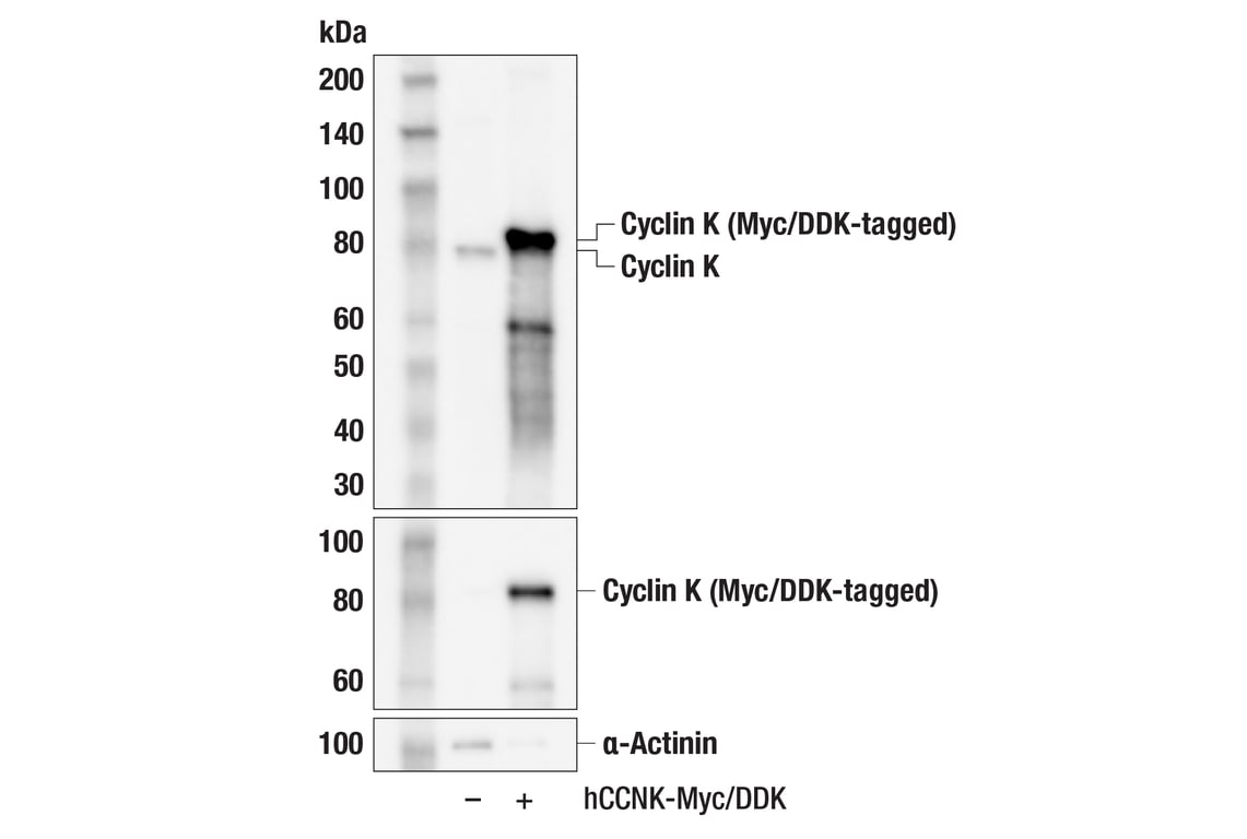 Western Blotting Image 4: Cyclin K (F1F2I) Rabbit Monoclonal Antibody