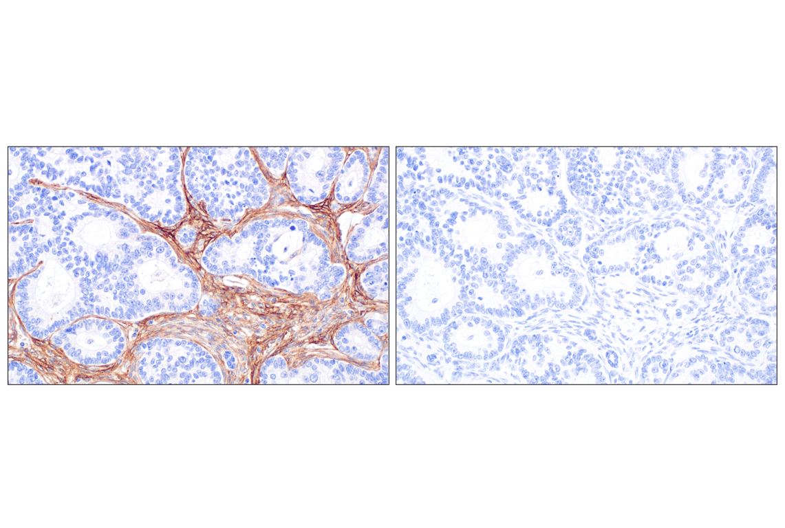 Immunohistochemistry Image 8: CD105/Endoglin (F9C5Q) Rabbit Monoclonal Antibody