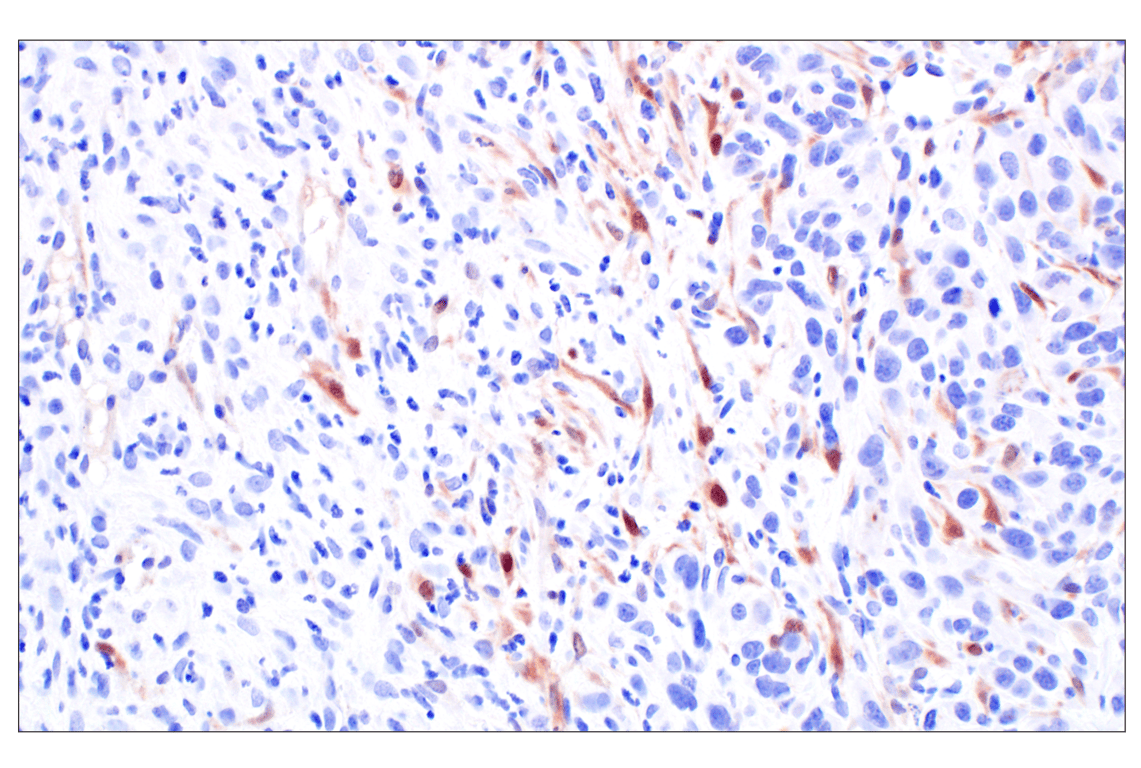 Immunohistochemistry Image 3: p16 INK4A (F2T7H) Rabbit Monoclonal Antibody