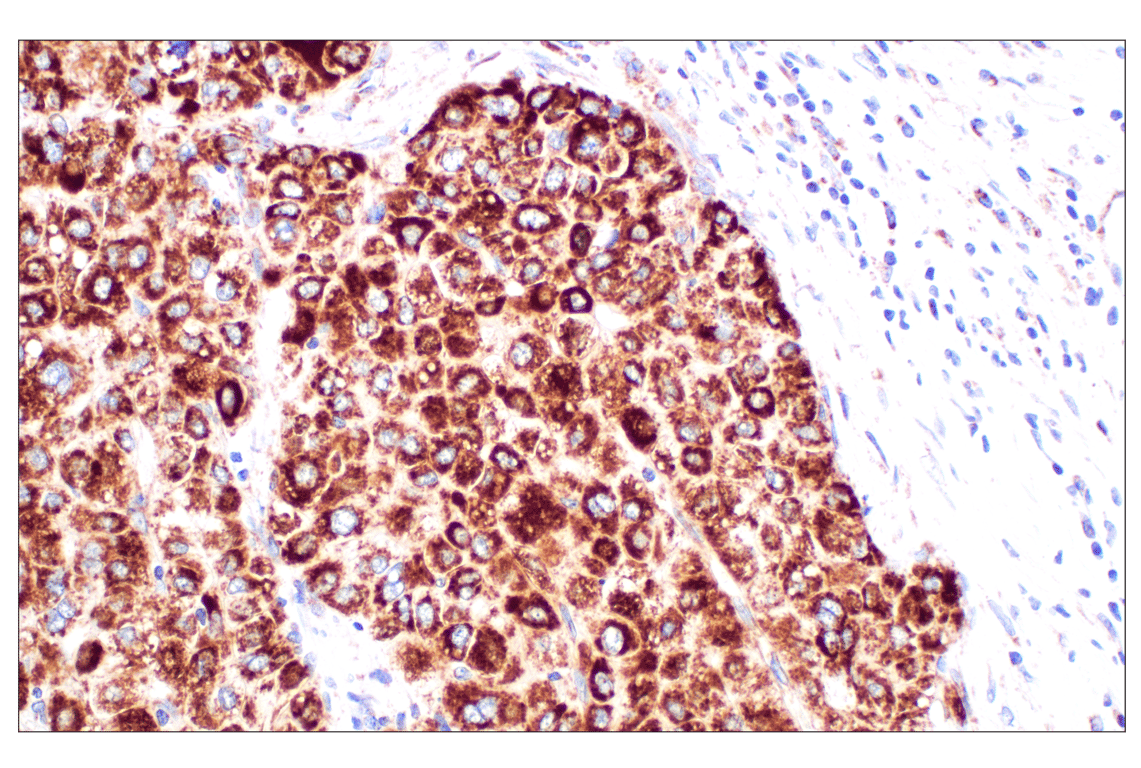 undefined Image 18: Organelle Localization IF Antibody Sampler Kit