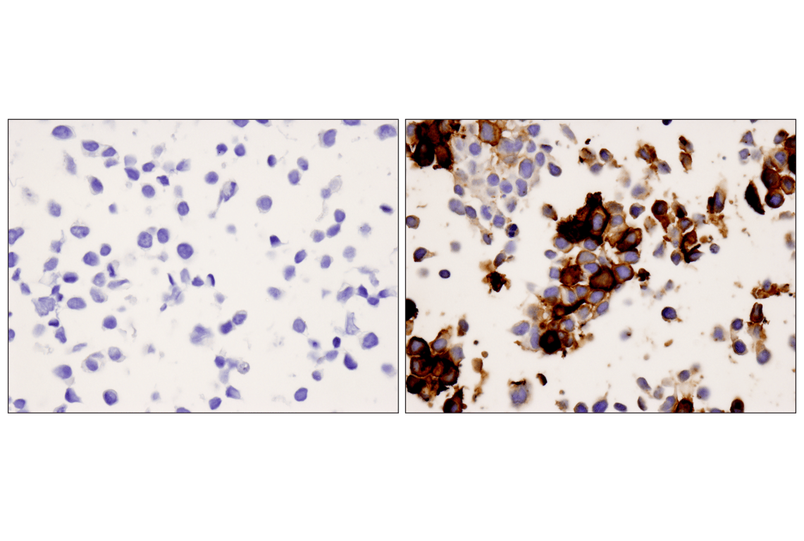 Immunohistochemistry Image 3: PD-1 (EH33) Mouse Monoclonal Antibody