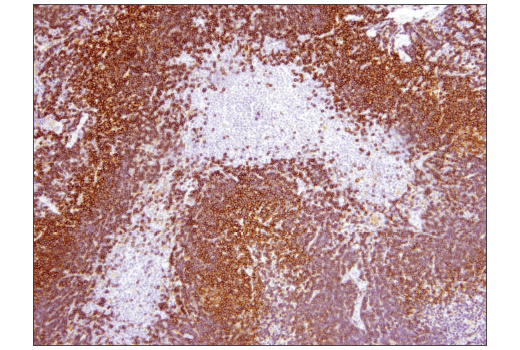 Immunohistochemistry Image 5: CD19 (Intracellular Domain) (D4V4B) Rabbit Monoclonal Antibody