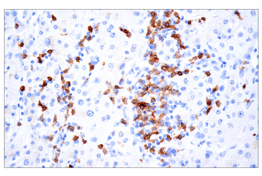 Immunohistochemistry Image 9: TRBC1/TCR beta constant region 1 (E6Z3S) Rabbit Monoclonal Antibody (BSA and Azide Free)