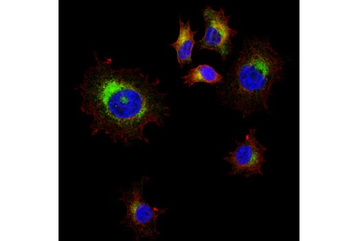 Immunofluorescence Image 1: VAMP2 (D6O1A) Rabbit Monoclonal Antibody (BSA and Azide Free)
