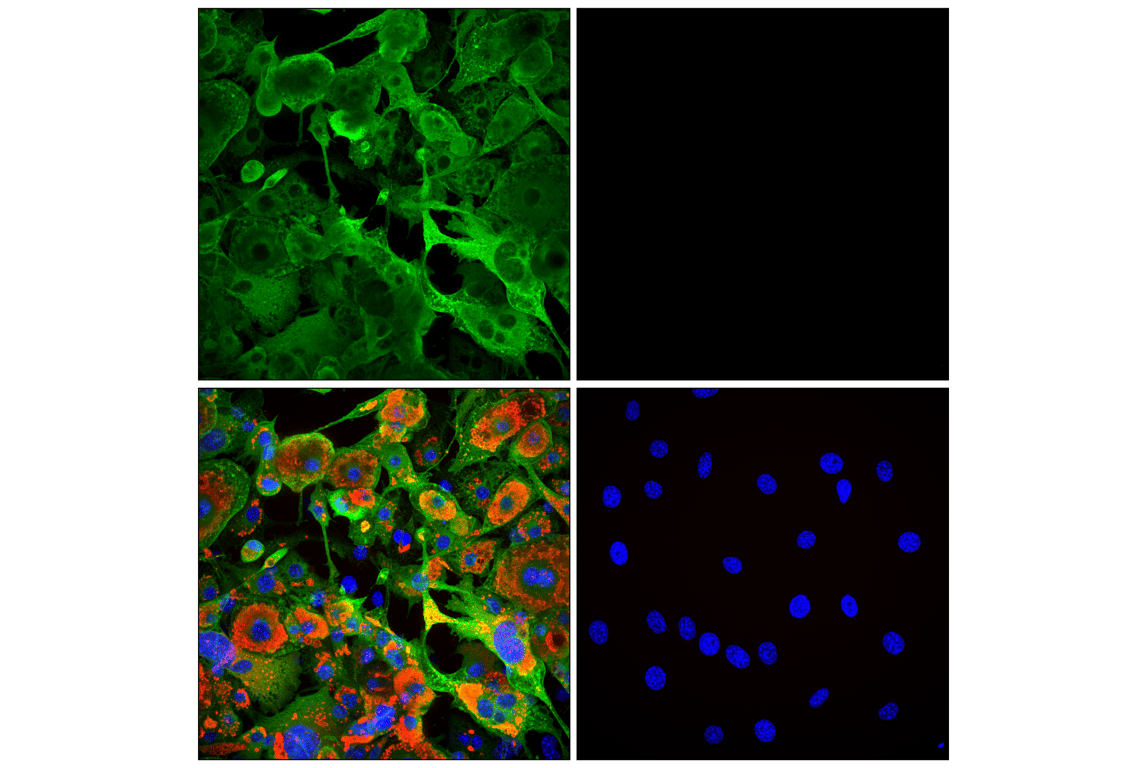 Immunofluorescence Image 2: HSL (D6W5S) Rabbit Monoclonal Antibody