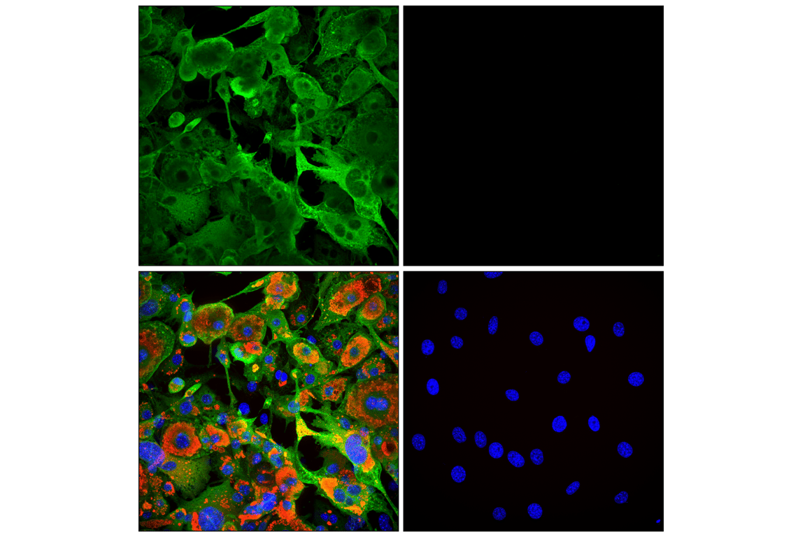 Immunofluorescence Image 2: HSL (D6W5S) XP<sup>®</sup> Rabbit mAb