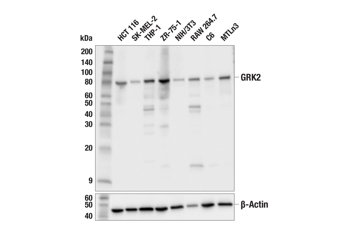 Western Blotting Image 2: GRK2 (E8A7E) Rabbit Monoclonal Antibody