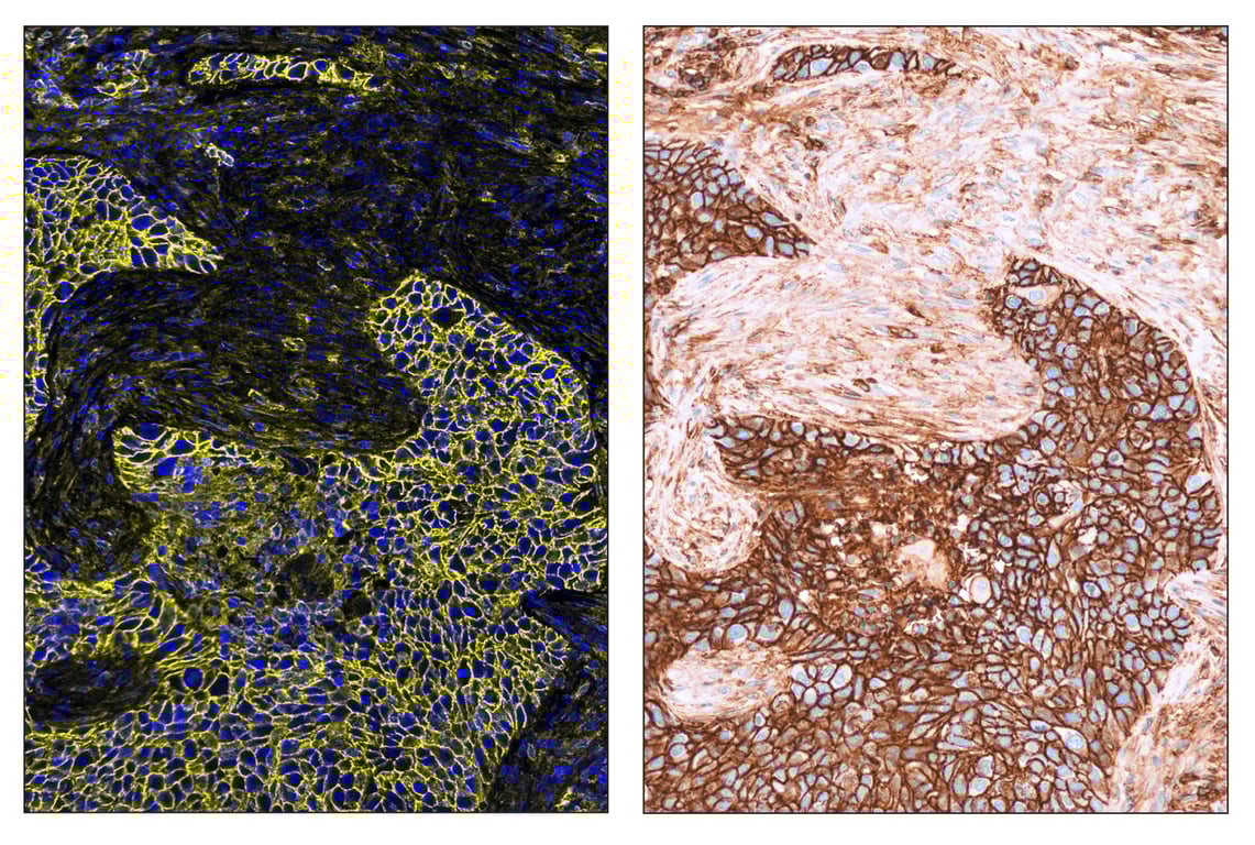 Immunohistochemistry Image 6: CD44 (E7K2Y) & CO-0030-594 SignalStar<sup>™</sup> Oligo-Antibody Pair