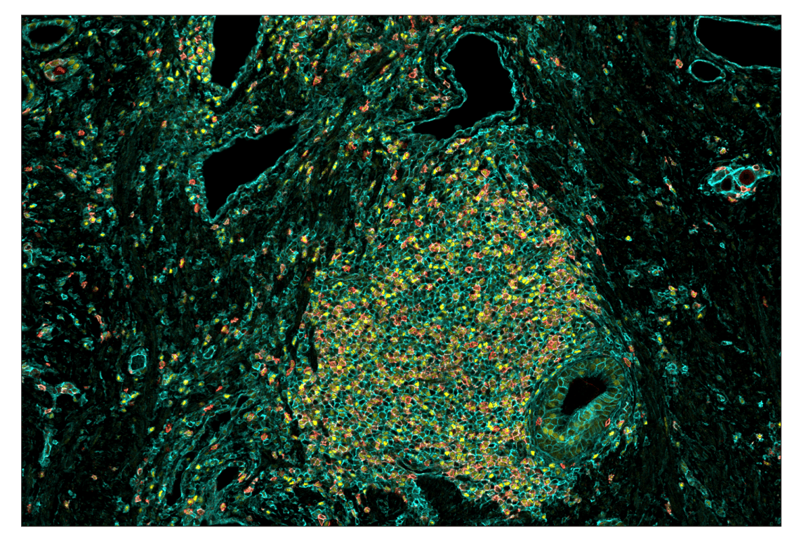Immunohistochemistry Image 1: MHC Class I (EMR8-5) & CO-0082-647 SignalStar<sup>™</sup> Oligo-Antibody Pair