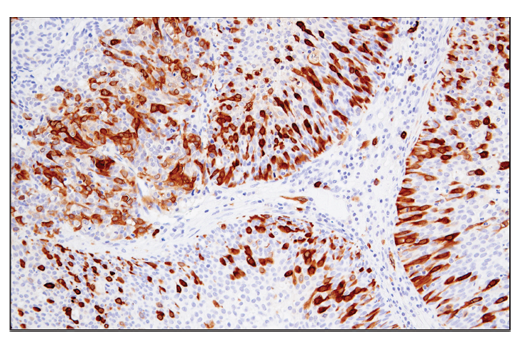 Immunohistochemistry Image 2: RRM2 (E7Y9J) Rabbit Monoclonal Antibody
