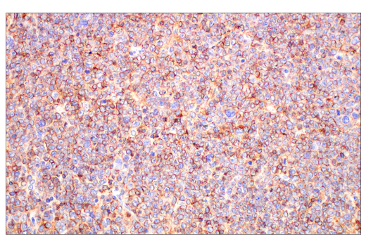Immunohistochemistry Image 1: CD20 (E3N7O) Rabbit Monoclonal Antibody (BSA and Azide Free)