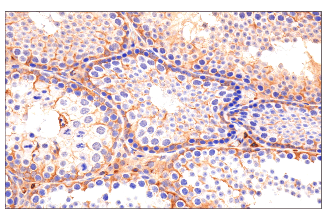 Immunohistochemistry Image 6: Caspase-8 (F5K9P) Rabbit Monoclonal Antibody