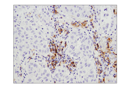 Immunohistochemistry Image 2: CD19 (Intracellular Domain) (D4V4B) Rabbit Monoclonal Antibody (BSA and Azide Free)