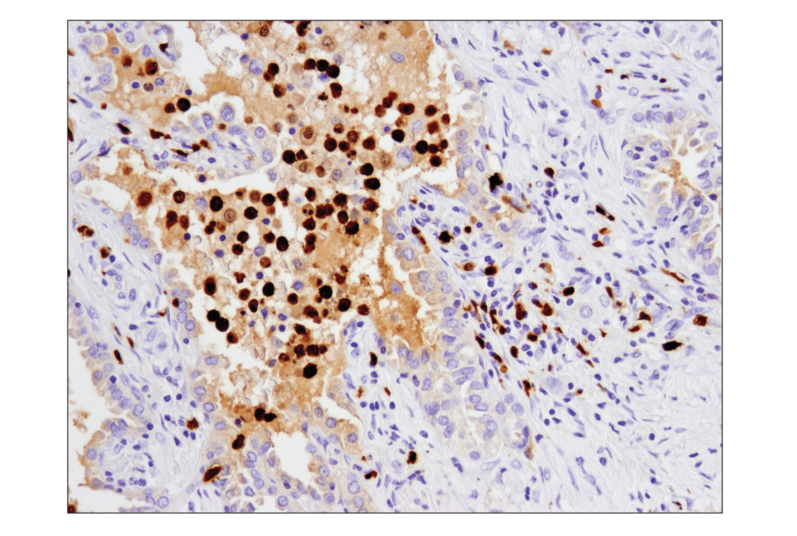 Immunohistochemistry Image 2: S100A9 (D5O6O) Rabbit Monoclonal Antibody (BSA and Azide Free)