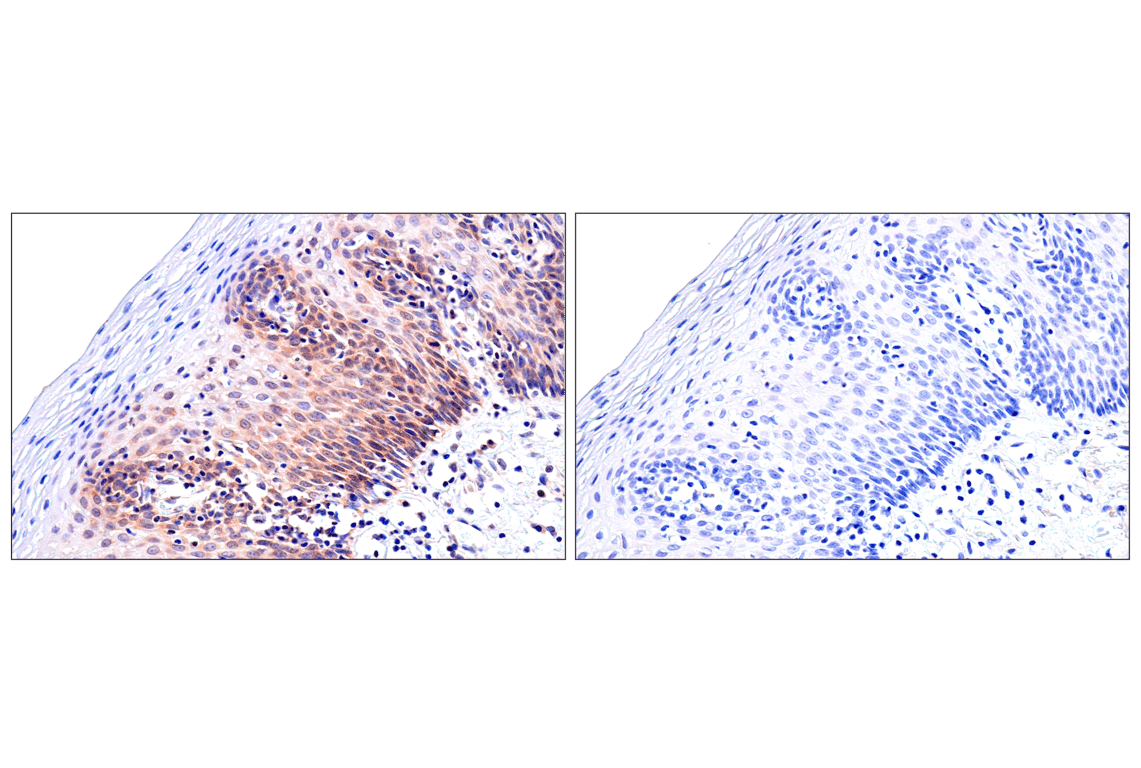 Immunohistochemistry Image 12: ADAR1 p150 Isoform (E6U1U) Rabbit Monoclonal Antibody