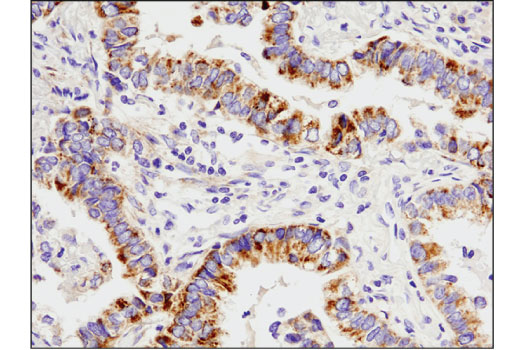 Immunohistochemistry Image 1: FGF Receptor 2 (D4L2V) Rabbit Monoclonal Antibody (BSA and Azide Free)