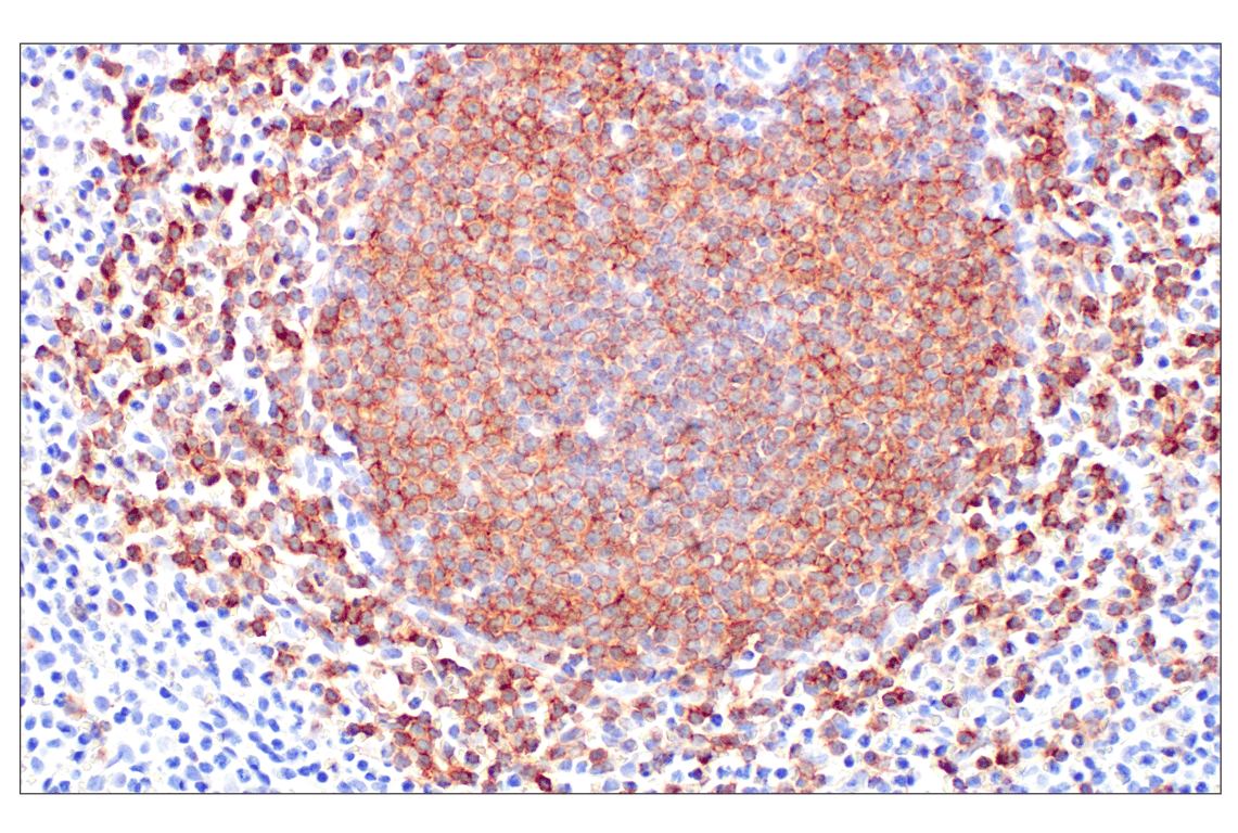 Immunohistochemistry Image 6: CD19 (Intracellular Domain) (D4V4B) Rabbit Monoclonal Antibody