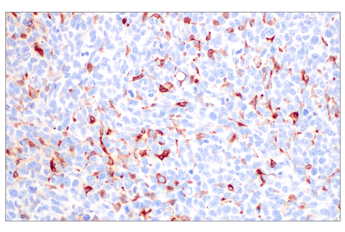 Immunohistochemistry Image 9: FTL (F9O4I) Rabbit Monoclonal Antibody