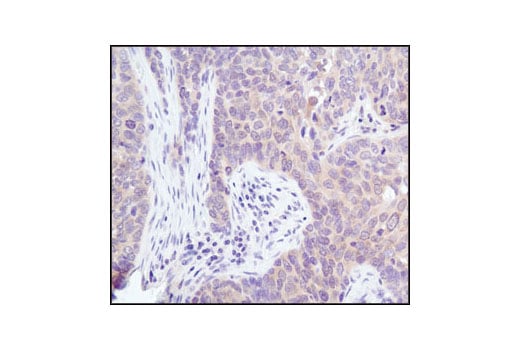 Immunohistochemistry Image 2: Akt (pan) (11E7) Rabbit Monoclonal Antibody (BSA and Azide Free)