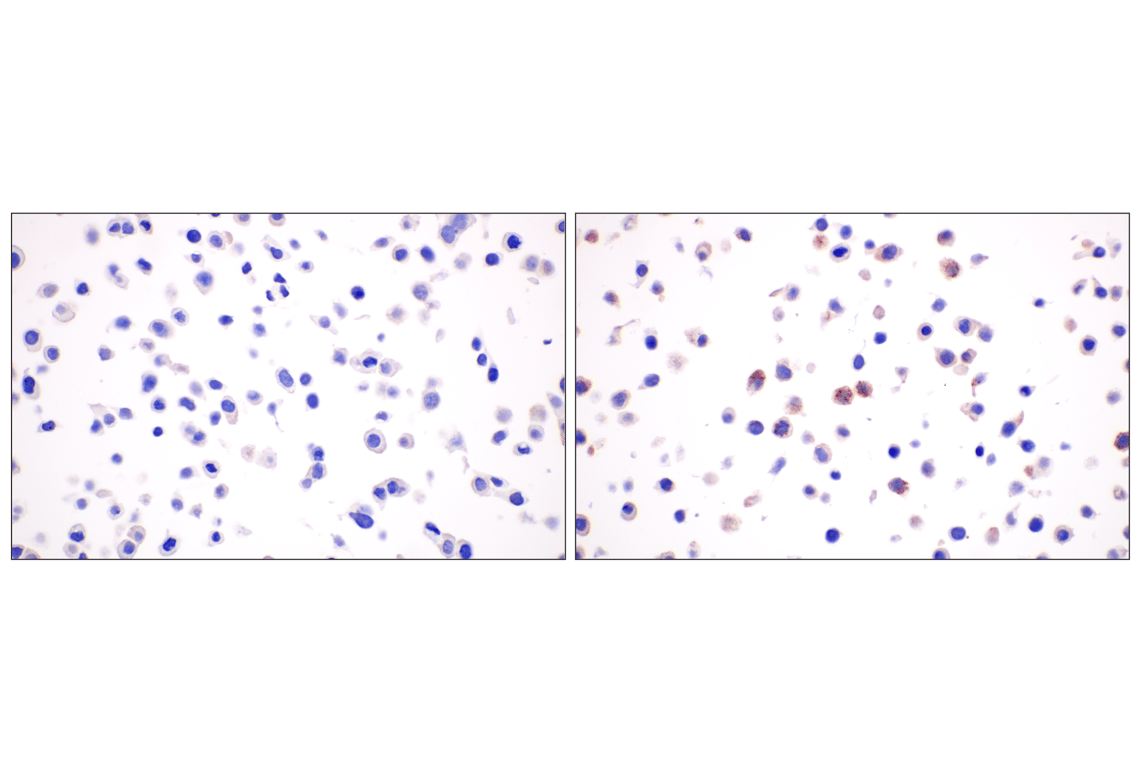 Immunohistochemistry Image 6: CXCL10 (F9N8I) Rabbit Monoclonal Antibody