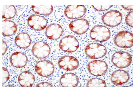 Immunohistochemistry Image 1: GUCY2C (E6I2U) Rabbit Monoclonal Antibody