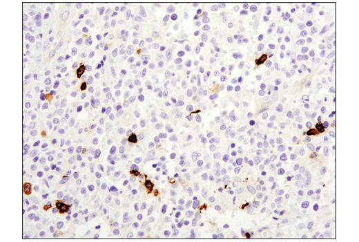 Immunohistochemistry Image 4: OX40 (E9U7O) XP<sup>®</sup> Rabbit mAb