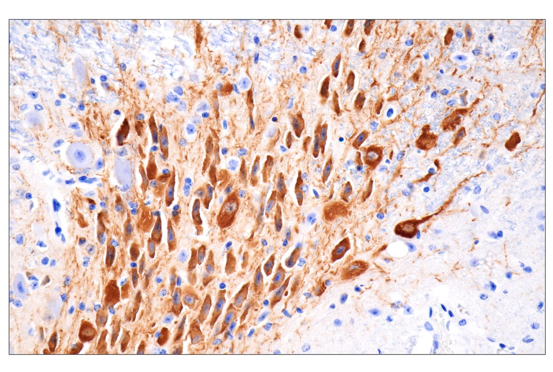 Immunohistochemistry Image 1: Tyrosine Hydroxylase (E2L6M) Rabbit Monoclonal Antibody (BSA and Azide Free)