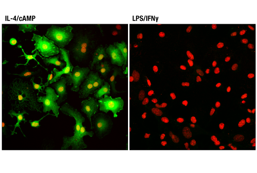Immunofluorescence Image 1: Arginase-1 (D4E3M) Rabbit Monoclonal Antibody (BSA and Azide Free)