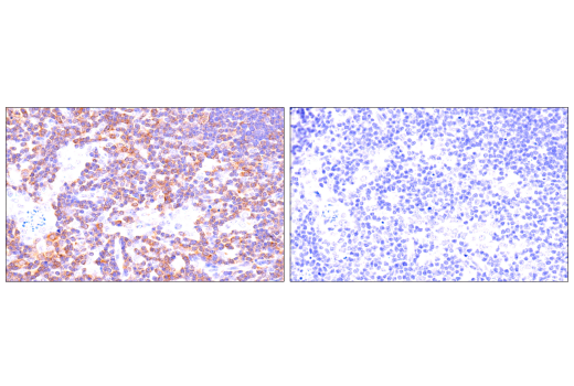 Immunohistochemistry Image 1: SLP-76 (E4N7E) Rabbit Monoclonal Antibody (BSA and Azide Free)