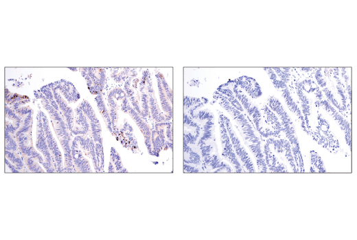undefined Image 29: p62/KEAP1/NRF2 Pathway Antibody Sampler Kit