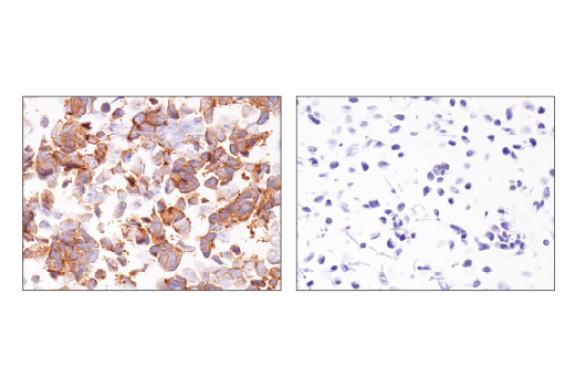 Immunohistochemistry Image 3: Notch2 (D76A6) Rabbit Monoclonal Antibody (BSA and Azide Free)