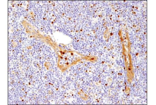 Immunohistochemistry Image 2: HSP70 (D1M6J) Mouse Monoclonal Antibody (BSA and Azide Free)