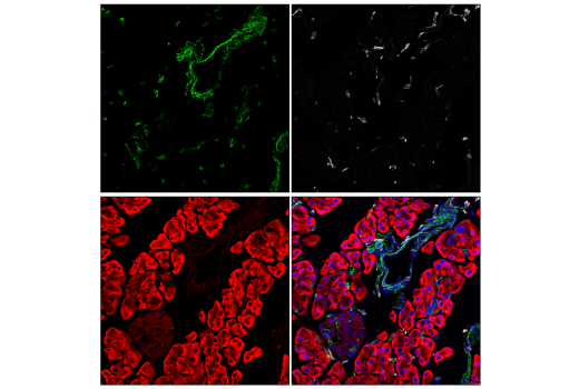 Immunofluorescence Image 2: Paxillin (E6R6Z) Rabbit Monoclonal Antibody (BSA and Azide Free)