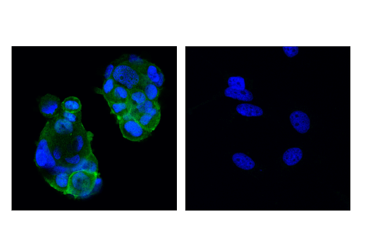 Immunofluorescence Image 1: PTK6/BRK (D4O2D) Rabbit Monoclonal Antibody