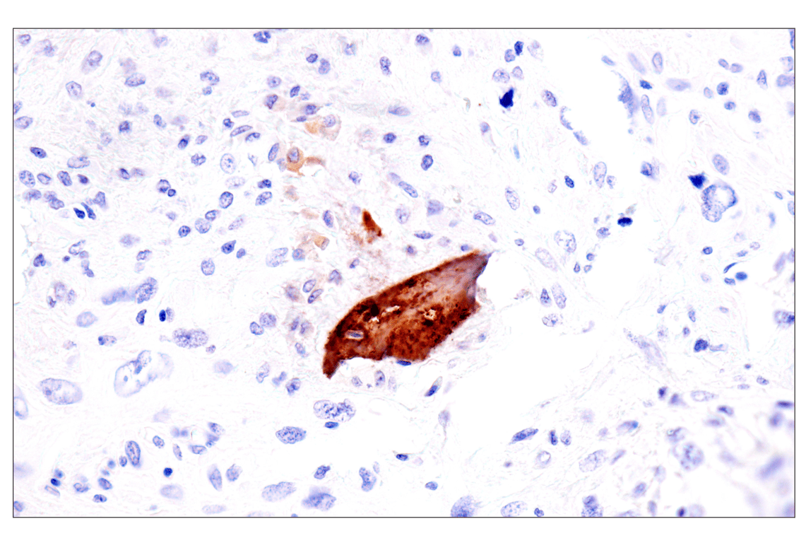 Immunohistochemistry Image 2: Osteocalcin (E8B9X) Rabbit Monoclonal Antibody
