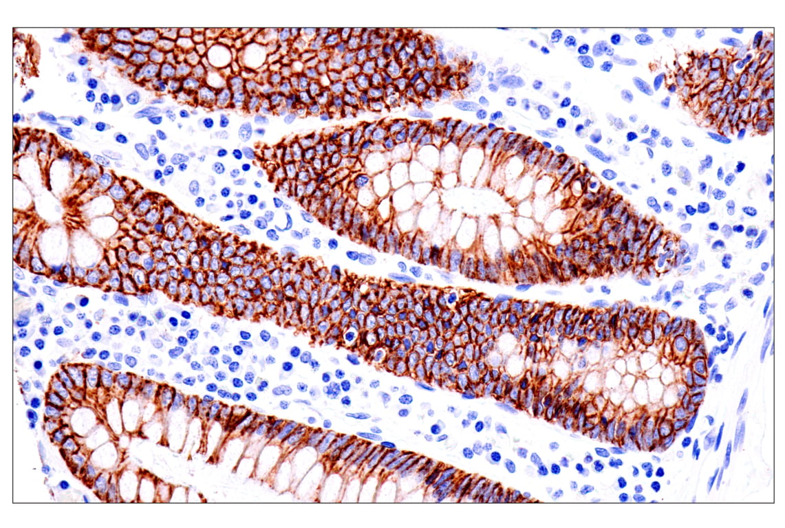 Immunohistochemistry Image 4: Cadherin-17 (E5J8Z) Rabbit Monoclonal Antibody
