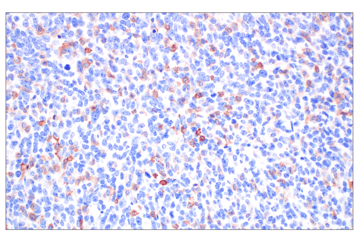 Immunohistochemistry Image 2: Dectin-1/ Clec7a (E3P5W) Rabbit Monoclonal Antibody
