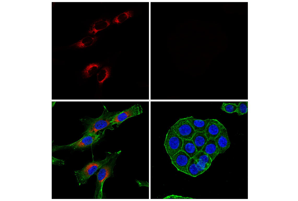 Immunofluorescence Image 1: COL1A1 (E8F4L) Rabbit Monoclonal Antibody (Alexa Fluor<sup>®</sup> 594 Conjugate)