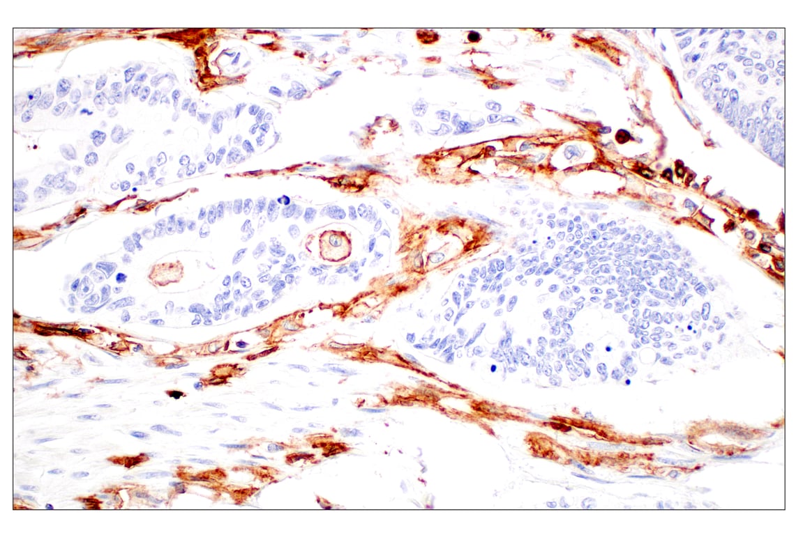 Immunohistochemistry Image 7: CD11b/ITGAM (E3J2F) Rabbit Monoclonal Antibody