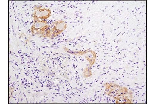 Immunohistochemistry Image 1: N-Cadherin (D4R1H) Rabbit Monoclonal Antibody