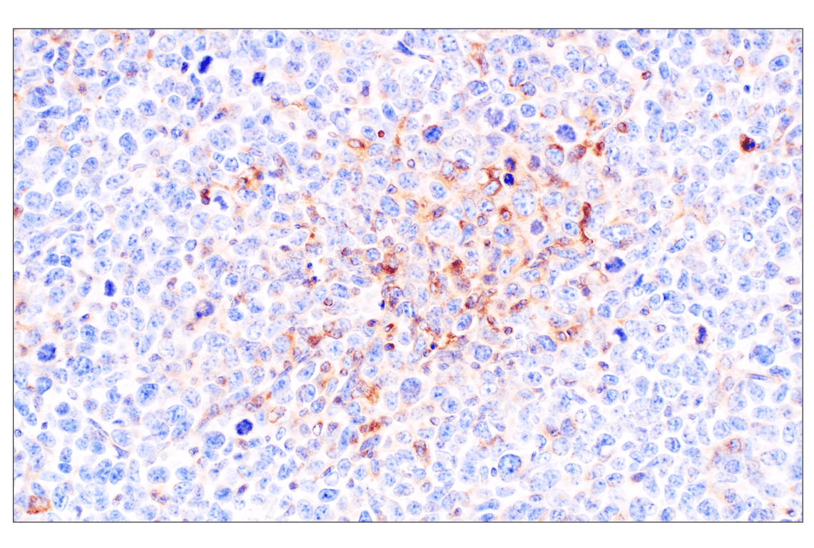 Immunohistochemistry Image 3: beta2-microglobulin (F4S6H) Rabbit Monoclonal Antibody