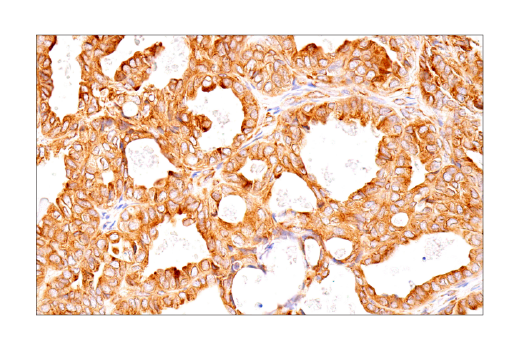 Immunohistochemistry Image 8: UBAP2L (E5X4E) Rabbit Monoclonal Antibody