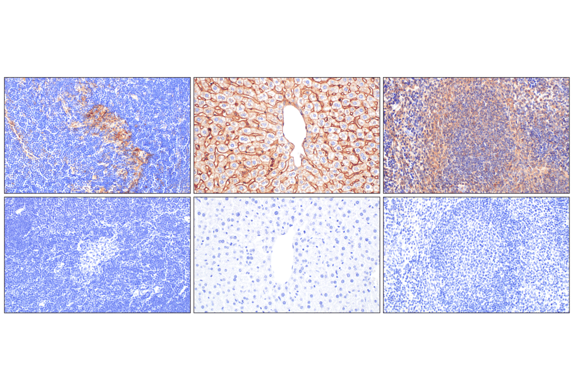 Immunohistochemistry Image 7: beta2-microglobulin (F4S6H) Rabbit Monoclonal Antibody